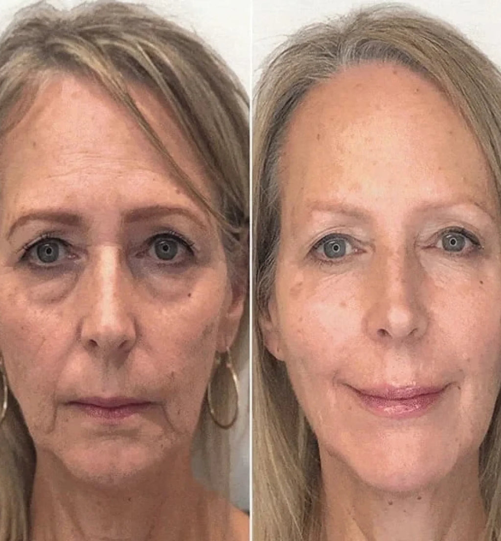 Solmera Anti Aging Serum